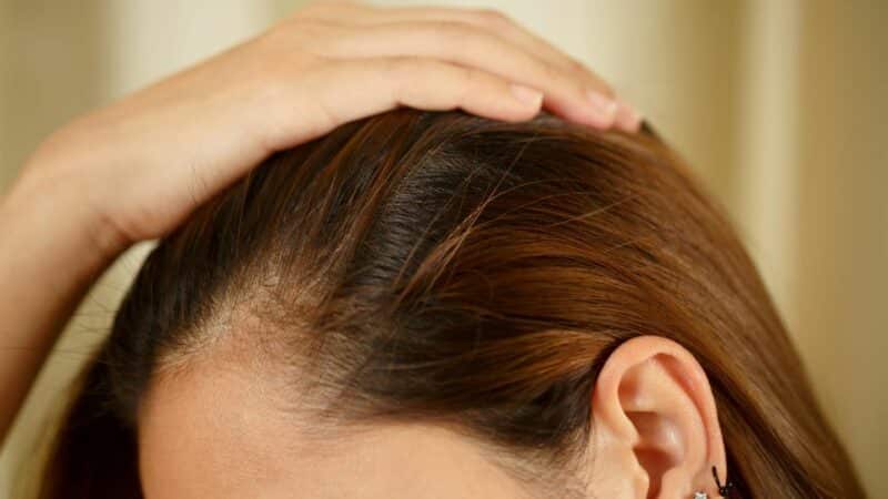 שיקום שיער ובריאות הקרקפת